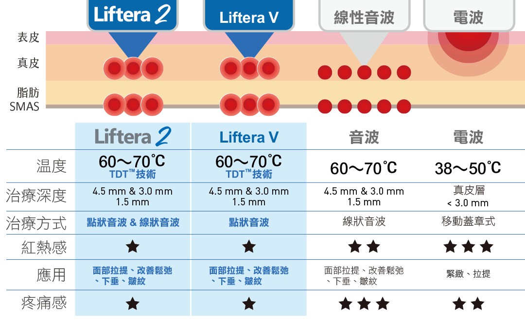 Liftera-V 立特拉渦旋音波與音波/電波比較表格 Liftera-V 立特拉渦旋音波與音波/電波比較表格