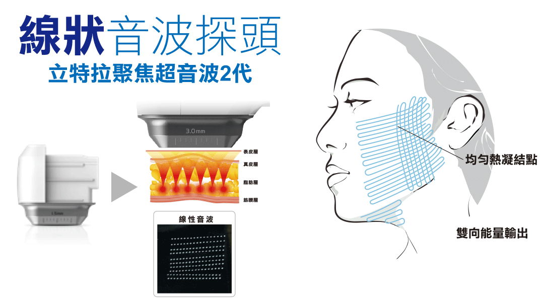線式渦漩音波探頭介紹 線式渦漩音波探頭介紹