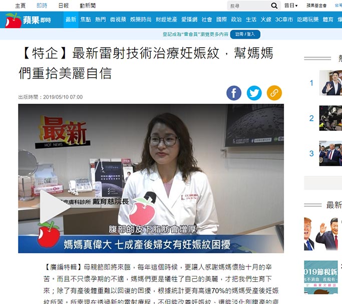 新雷射技術治療治療妊娠紋,幫媽媽們重拾美麗自信